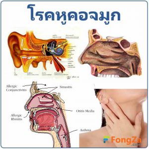 อาการทั่วไปของโรคหลอดลมอักเสบคืออะไร ?